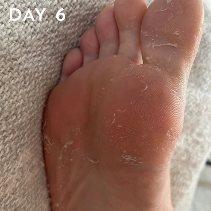 +maskology FOOT PEEL Professional Foot Treatment