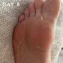 +maskology FOOT PEEL Professional Foot Treatment thumbnail