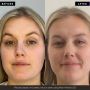 +maskology PHOTON LED light therapy face mask thumbnail